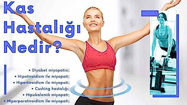 kas hastalığı nedir