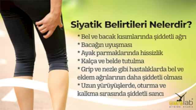 siyatik-belirtisi